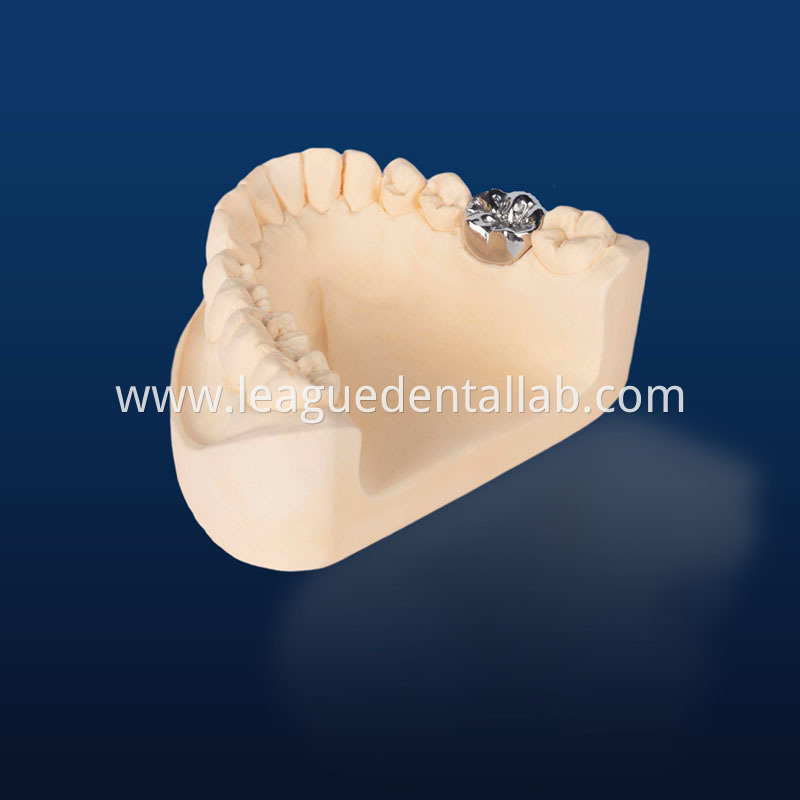 Full Gold crown,Full metal crown Non-precious, Full Metal crown Non-precious Yellow